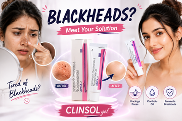 Say Goodbye to Stubborn Blackheads with Clinsol Gel