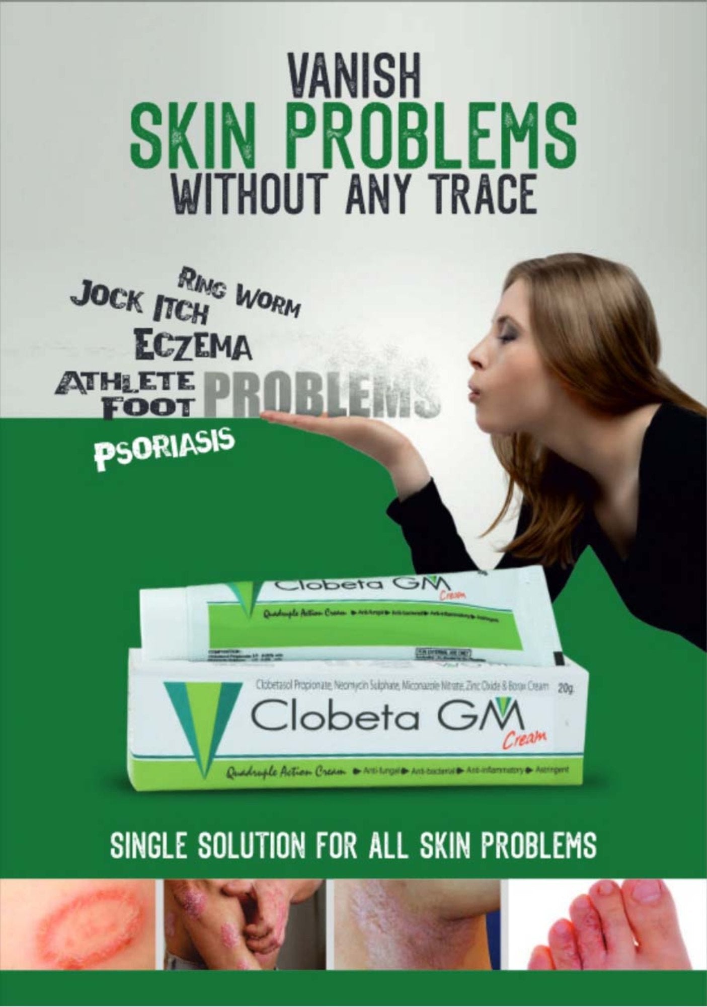 Clobeta GM Anti Fungal Infection Cream for skin care , Rash Cream , Itching , Eczema Cream Pack of 6